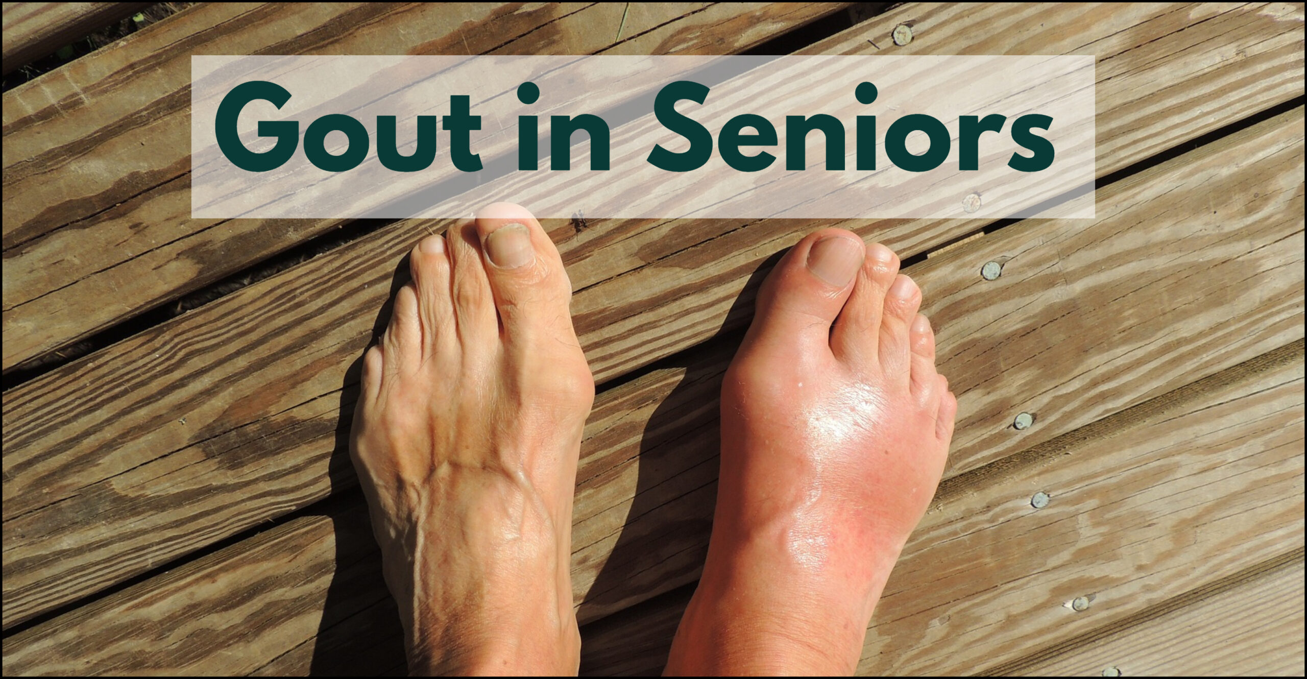 Gout in Seniors: Recognizing the Warning Signs and Addressing Complications