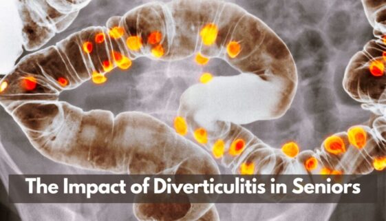 The Impact of Diverticulitis in Seniors